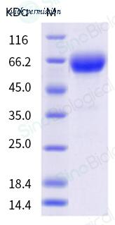 Sino Biological 10377-H41H-B image 1