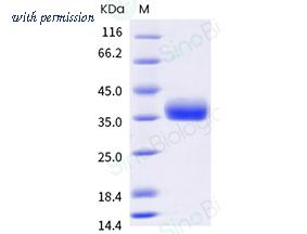 Sino Biological 40592-V08H123 image 1