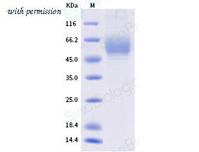Sino Biological 12241-H08H image 1