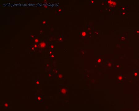 Sino Biological HG10327-ACR image 1