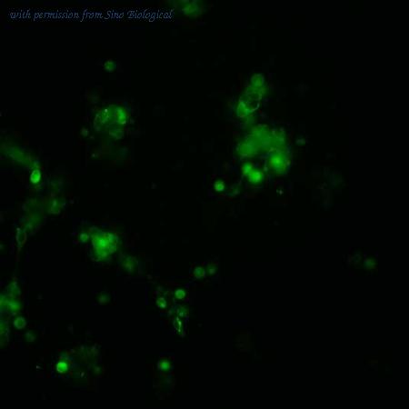 Sino Biological HG10653-ACG image 1