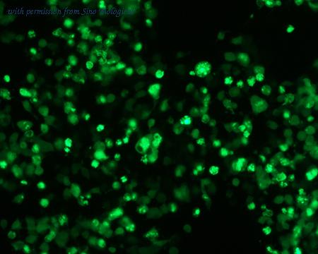 Sino Biological HG10763-ANG image 1