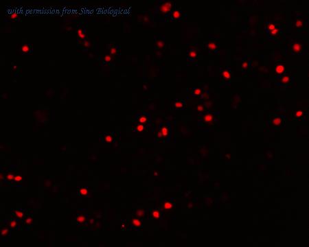 Sino Biological HG11206-ANR image 1