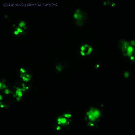 Sino Biological HG11415-ACG image 1