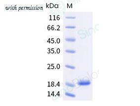 Sino Biological 321-Asp0010 image 1