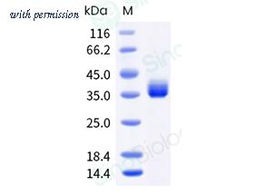 Sino Biological 40592-V08H141 image 1