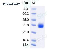 Sino Biological 40592-V08H140 image 1