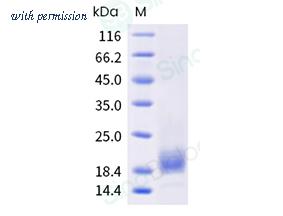 Sino Biological 10917-H08C image 1