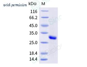 Sino Biological 12259-H56E-B image 1