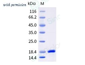 Sino Biological 10451-HNAE image 1