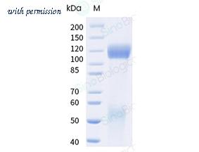 Sino Biological 10164-H49H1-B image 1