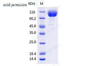 Sino Biological 10113-H49H-B image 1