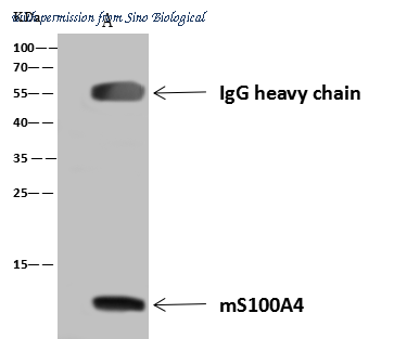 Sino Biological 50484-T20 image 1