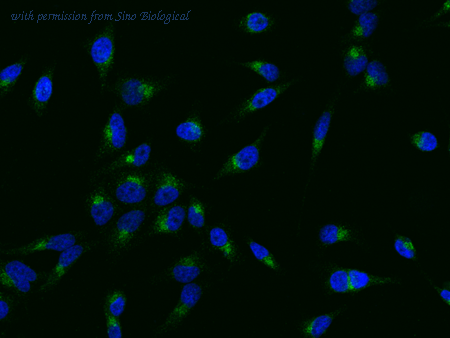 Sino Biological 13863-M308 image 1