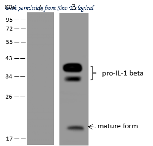 Sino Biological 108698-MM05T image 1