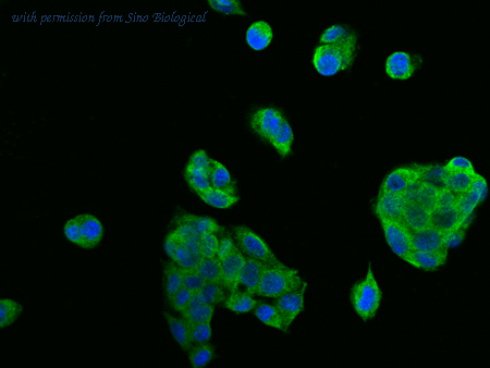 Sino Biological 10465-M309 image 1