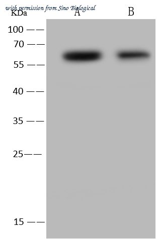 Sino Biological 101715-T32 image 1