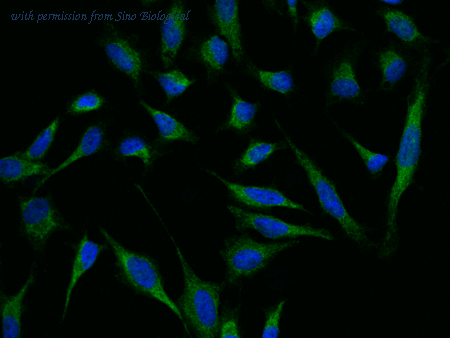 Sino Biological 100996-T02 image 1