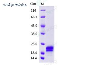 Sino Biological 11066-HNAB image 1