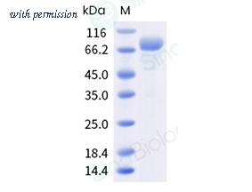 Sino Biological 10350-H41C-B image 1