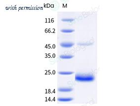 Sino Biological 10250-H08H image 1