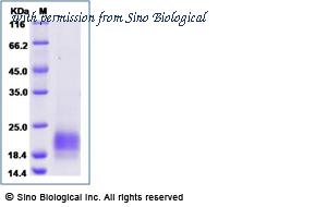 Sino Biological 10977-H08S-B image 1