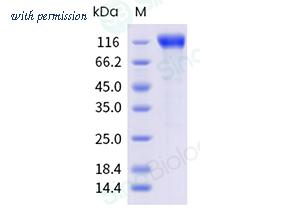 Sino Biological 11073-H41H-B image 1