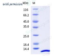 Sino Biological 11609-HNAE image 1