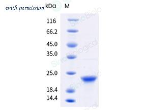 Sino Biological 12093-H49E-B image 1