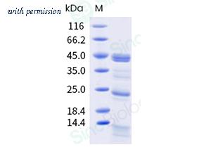 Sino Biological 320-BLA0130 image 1