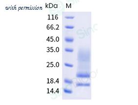 Sino Biological 340-FRA0030 image 1