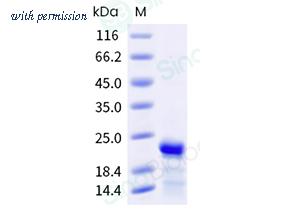 Sino Biological 504-BNP0010 image 1