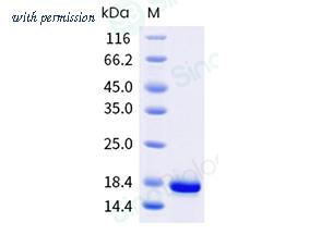 Sino Biological 505-MYO0020 image 1
