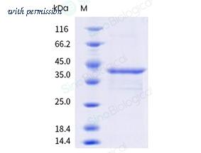 Sino Biological 334-CUP0010 image 1
