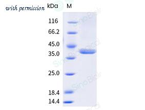 Sino Biological 401-PG0080 image 1