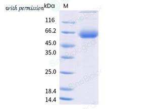 Sino Biological 40997-VNAH3 image 1