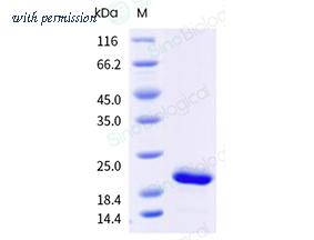 Sino Biological 10602-H49H-B image 1