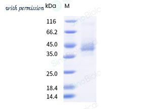 Sino Biological 13022-H91H-NA image 1