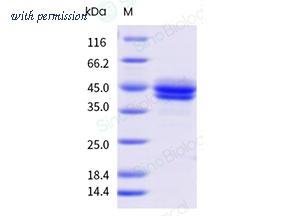 Sino Biological 13032-H41H-B image 1