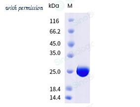 Sino Biological 41017-V08E image 1