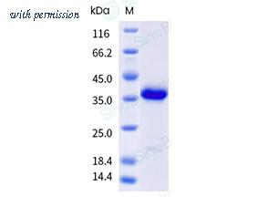 Sino Biological 304-GLYM0040 image 1