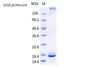 Sino Biological 304-GLYM0050 image 1