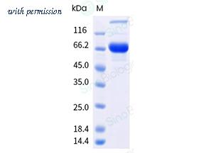 Sino Biological 304-GLYM0080 image 1
