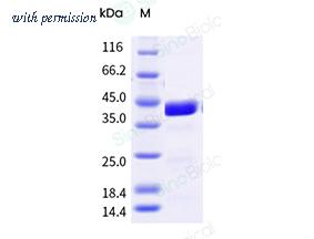 Sino Biological 40440-VCCB image 1
