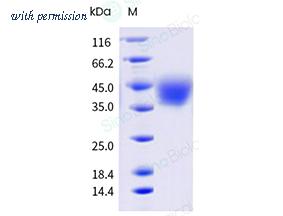 Sino Biological 62013-U49H-B image 1