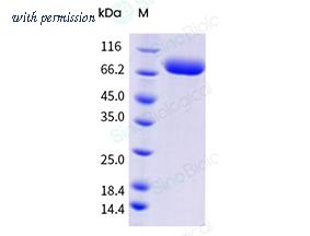 Sino Biological 80150-R07H-B image 1