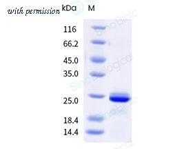 Sino Biological 83944-R08H image 1