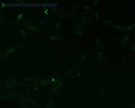 Sino Biological HG11020-ACG image 1