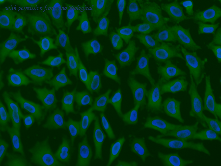 Sino Biological 29993-MM06 image 1