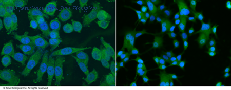 Sino Biological 11388-MM03 image 1